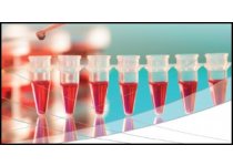 Pakiet gotowych metod do analizy immunosupresantów KIT DOSIMUNE™
