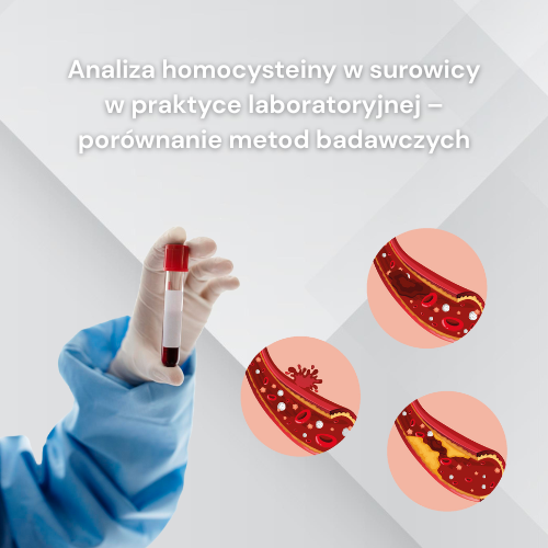 Analiza homocysteiny w&nbsp;surowicy